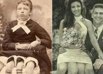 Meet Josephine Myrtle Corbin, The Lady Born With Four Legs & Two Private Parts
