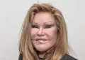 Jocelyn Wildenstein Before Plastic Surgery: See Her face Different look